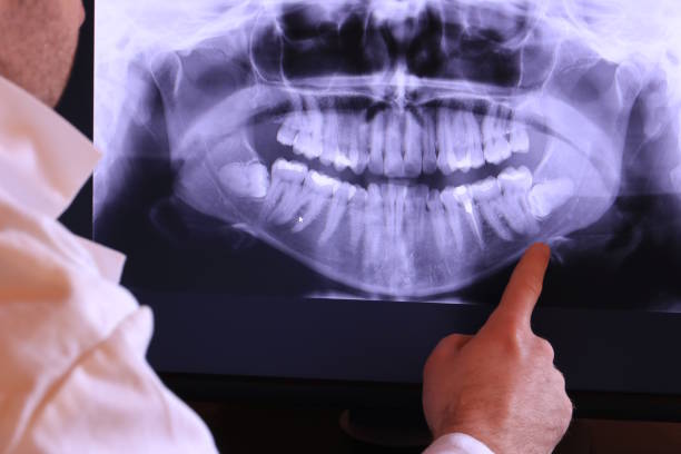 Best Emergency Treatment for Dental Infections or Abscesses in Post, TX